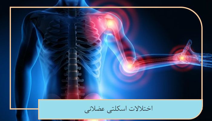 اختلالات-اسکلتی-عضلانی