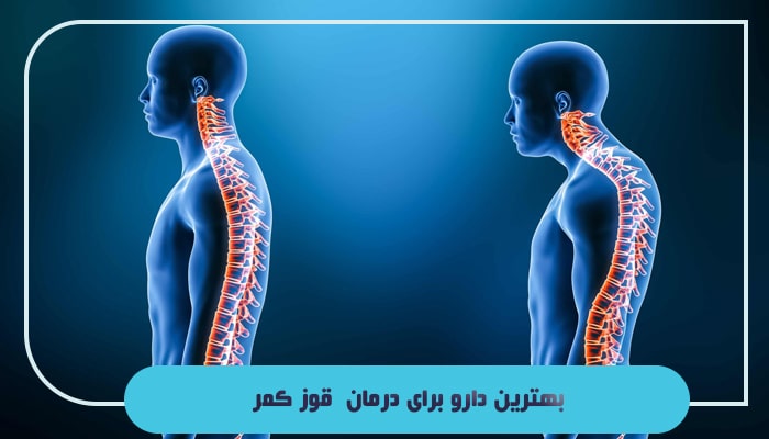 قوز کمر یا کیفوز چیست؛ آیا این بیماری 100 درصد قابل درمان است؟ 5 بهترین دارو برای درمان قوز کمر
