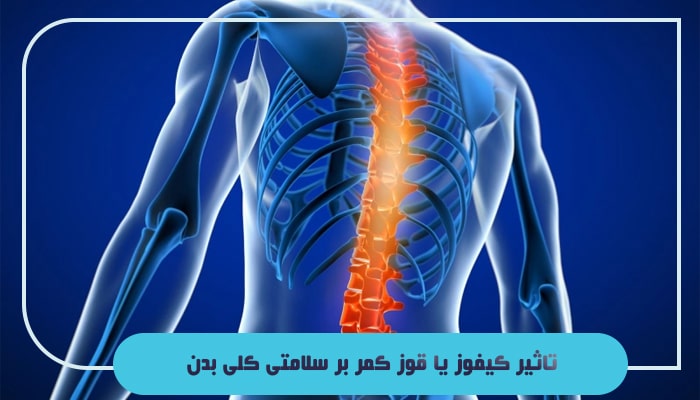 قوز کمر یا کیفوز چیست؛ آیا این بیماری 100 درصد قابل درمان است؟ 6 تاثیر کیفوز یا قوز کمر بر سلامتی کلی بدن