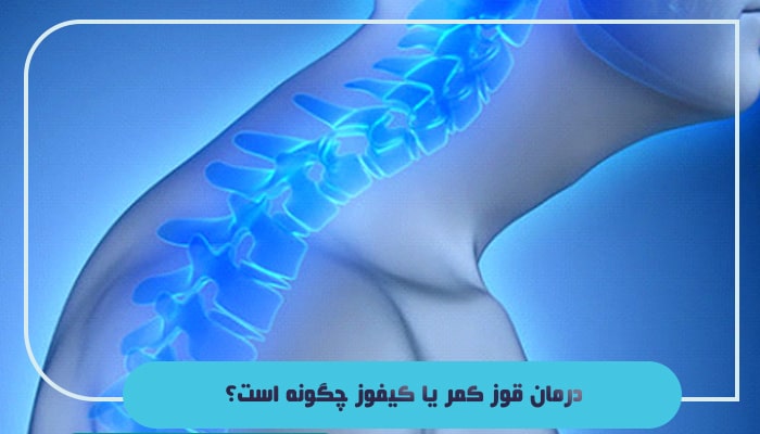 قوز کمر یا کیفوز چیست؛ آیا این بیماری 100 درصد قابل درمان است؟ 4 درمان قوز کمر یا کیفوز چگونه است؟