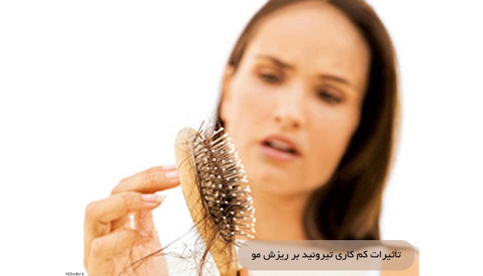 کم کاری تیروئید؛ علل، علائم و 1 درمان موثر 5 تأثیرات کم کاری تیروئید بر ریزش مو