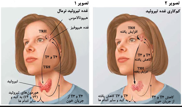 هورمون‌ها در بیماری کم کاری تیروئید
