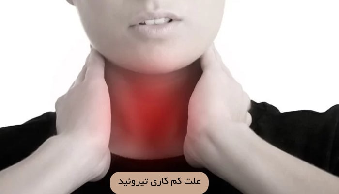 کم کاری تیروئید؛ علل، علائم و 1 درمان موثر 2 علت کم کاری تیروئید