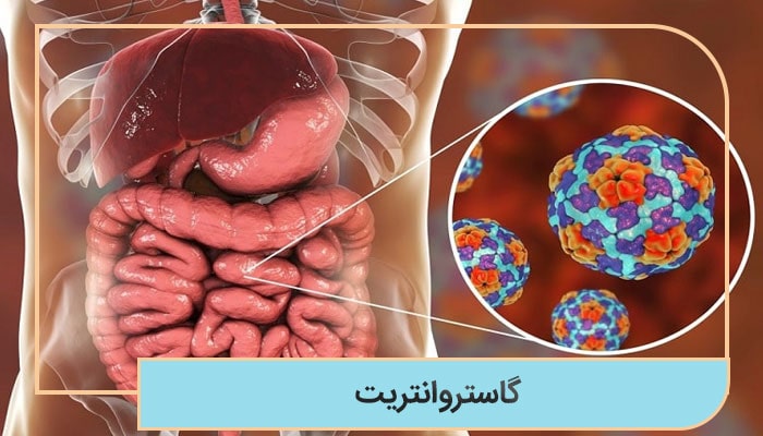 گاستروانتریت
