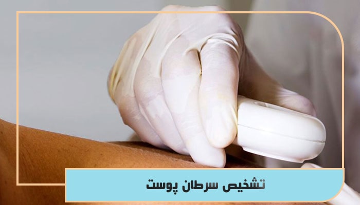 تشخیص سرطان پوست