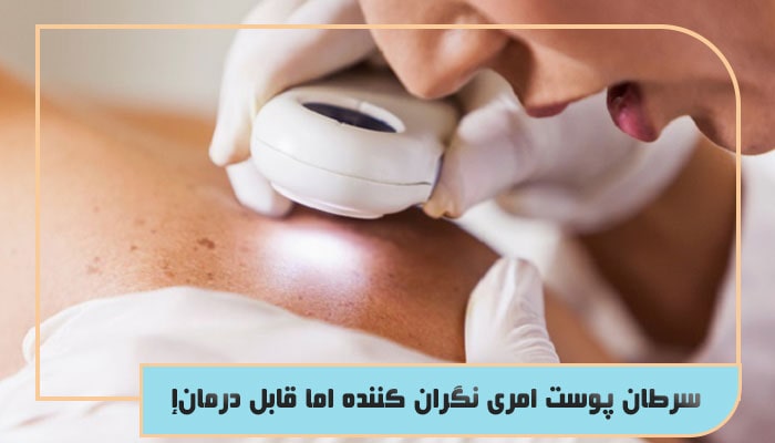 سرطان پوست امری نگران کننده اما قابل درمان!