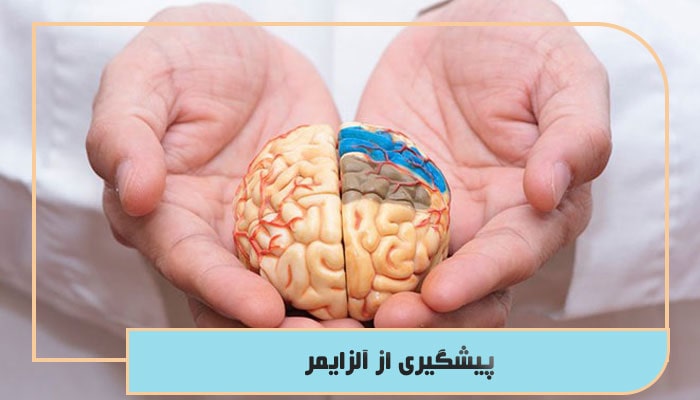 پیشگیری از آلزایمر